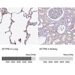 SP-B/Surfactant Protein B Antibody, Novus Biologicals 0.1mL; Unlabeled:Antibodies,